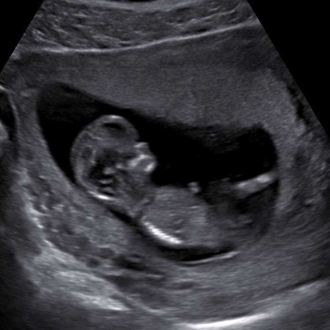 Photo shared by Chelsie for their Babylist baby registry.