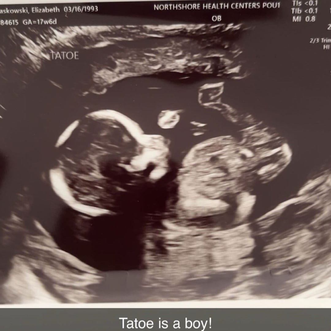 Photo shared by Elizabeth for their Babylist baby registry.