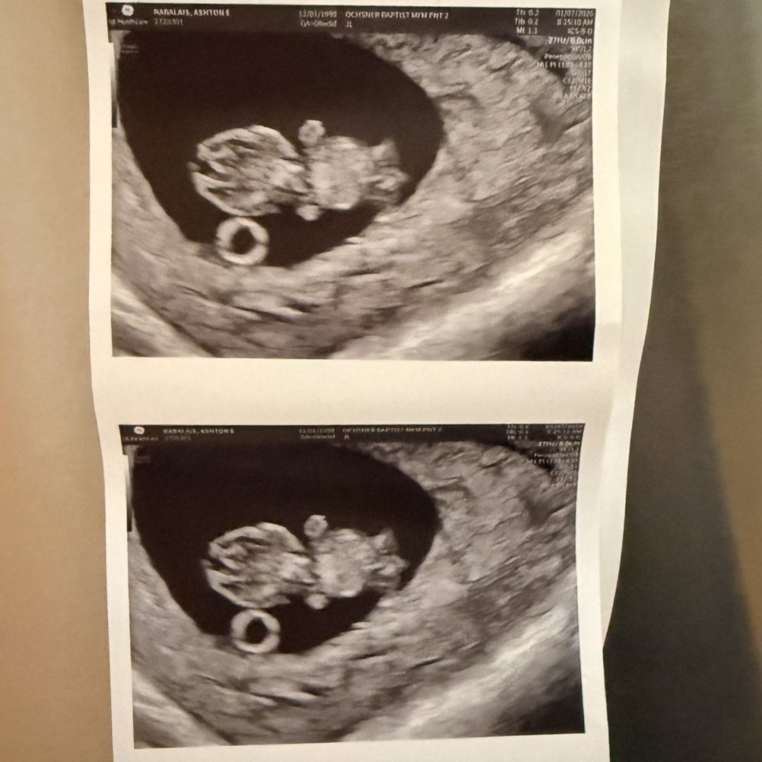 Photo shared by Ashton for their Babylist baby registry.