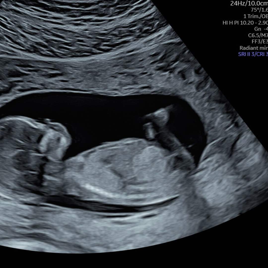Photo shared by Emmunah for their Babylist baby registry.