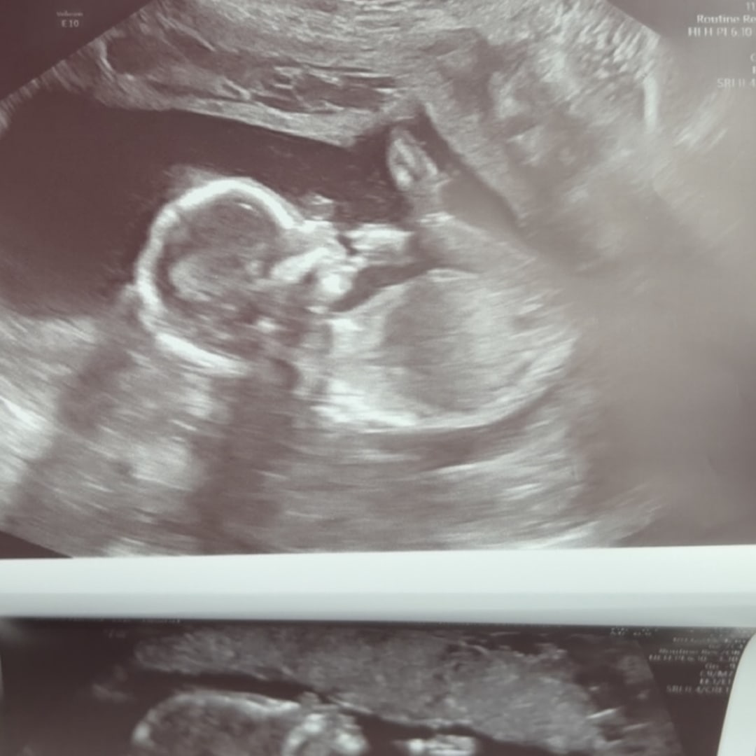 Photo shared by Hailey for their Babylist baby registry.