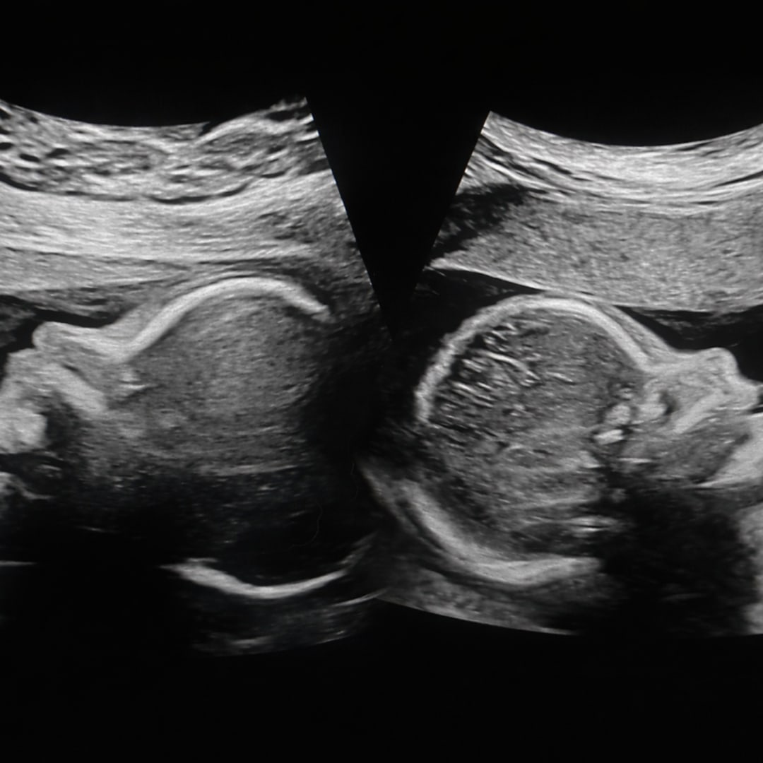 Photo shared by Hannah for their Babylist baby registry.