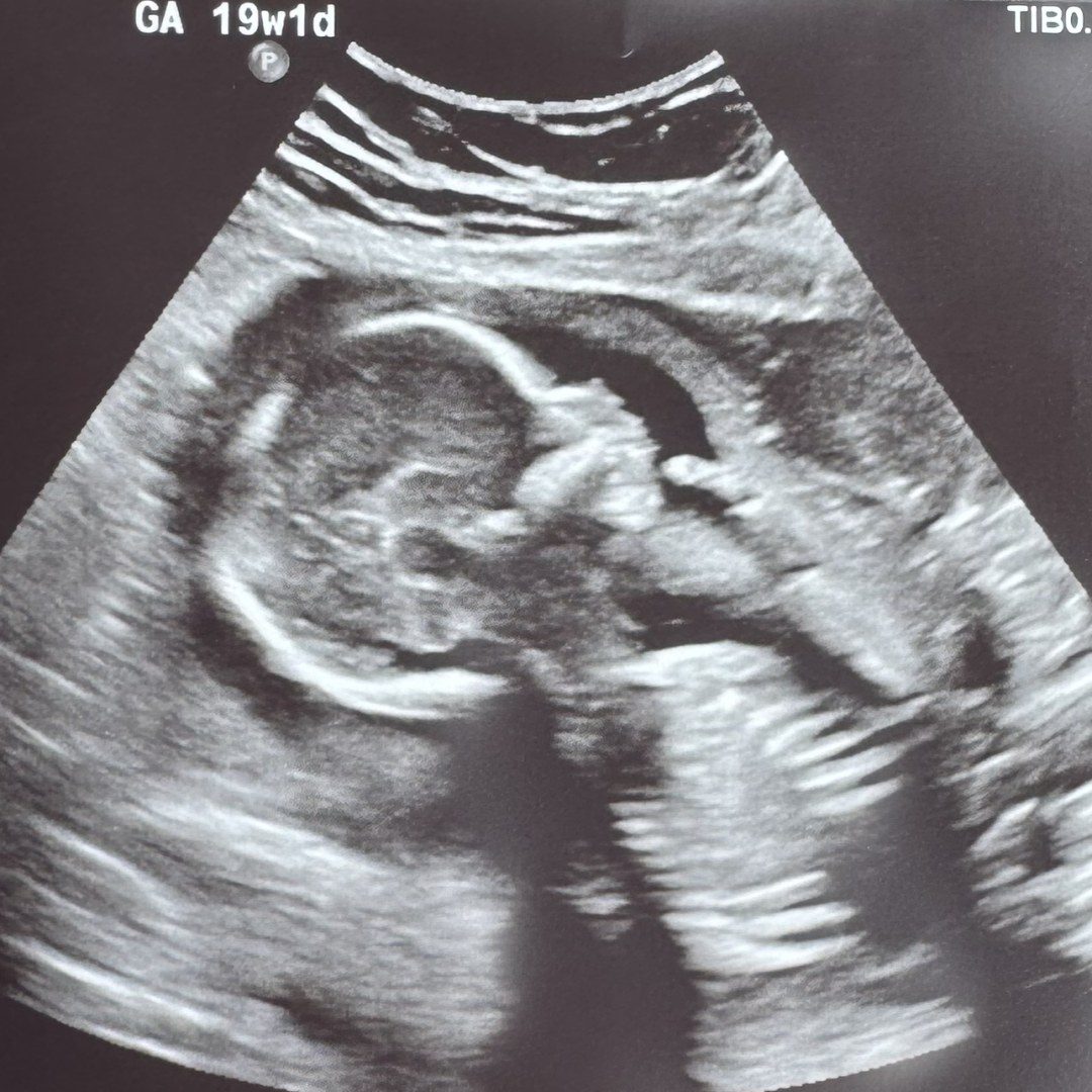 Photo shared by Libby for their Babylist baby registry.