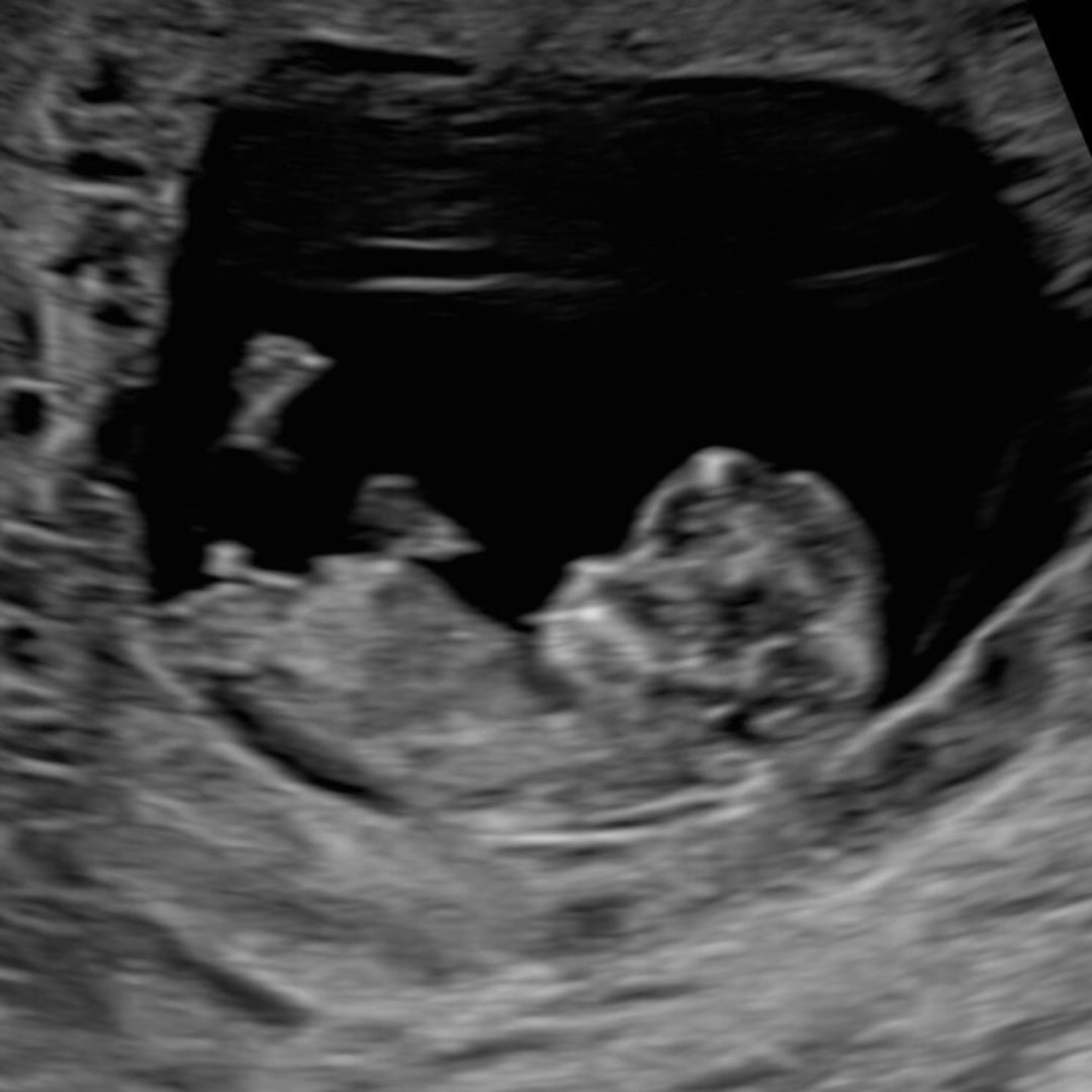 Photo shared by Ella for their Babylist baby registry.