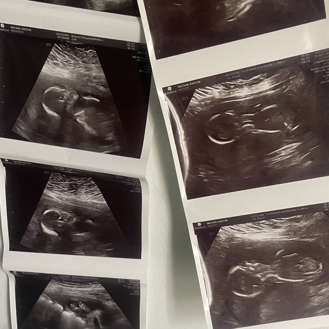 Photo shared by Kaitlyn for their Babylist baby registry.