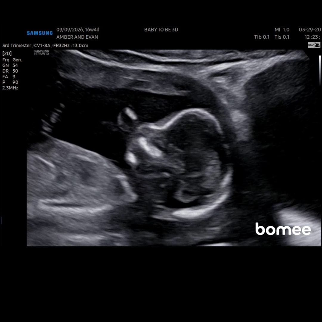 Photo shared by Amber for their Babylist baby registry.