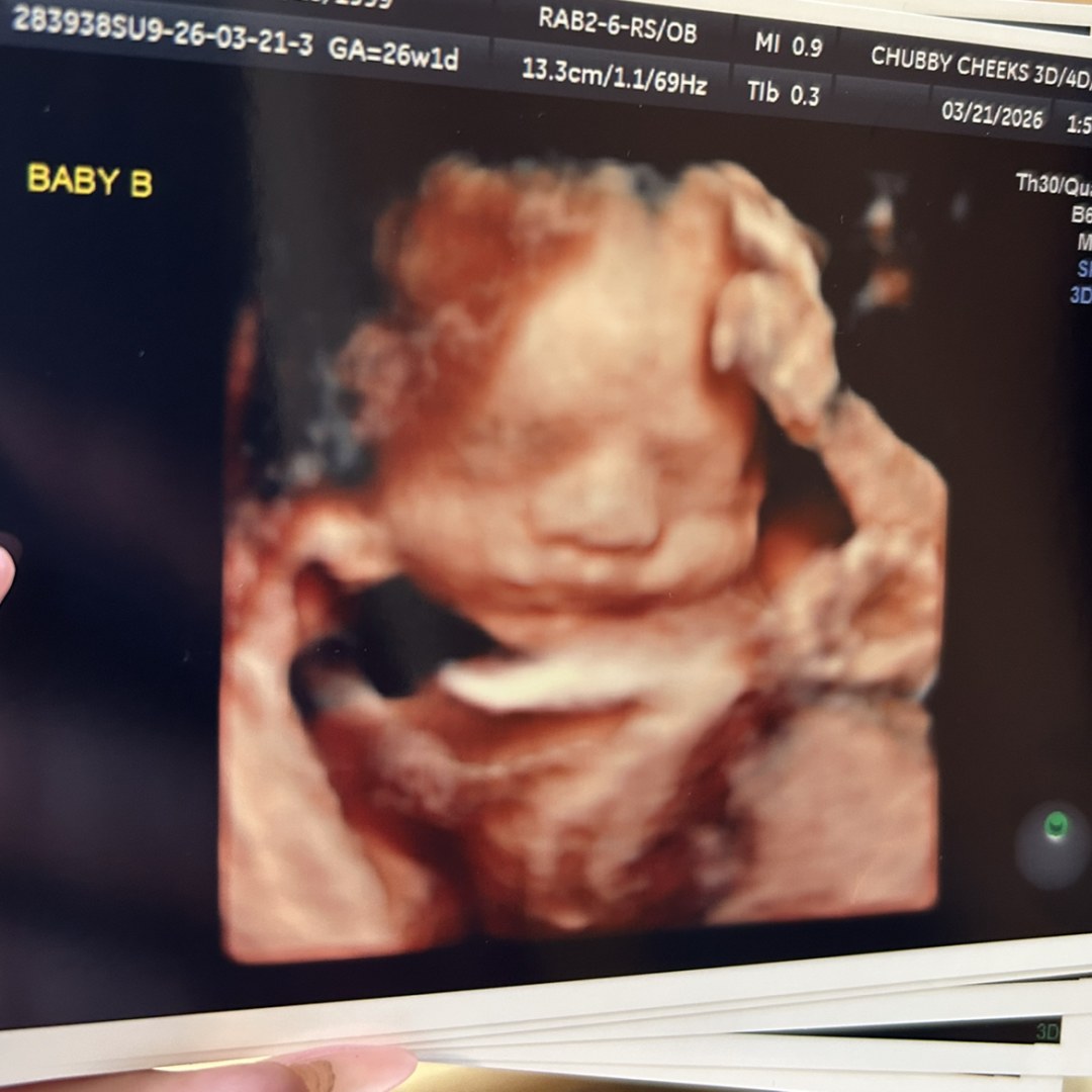 Photo shared by Jami for their Babylist baby registry.