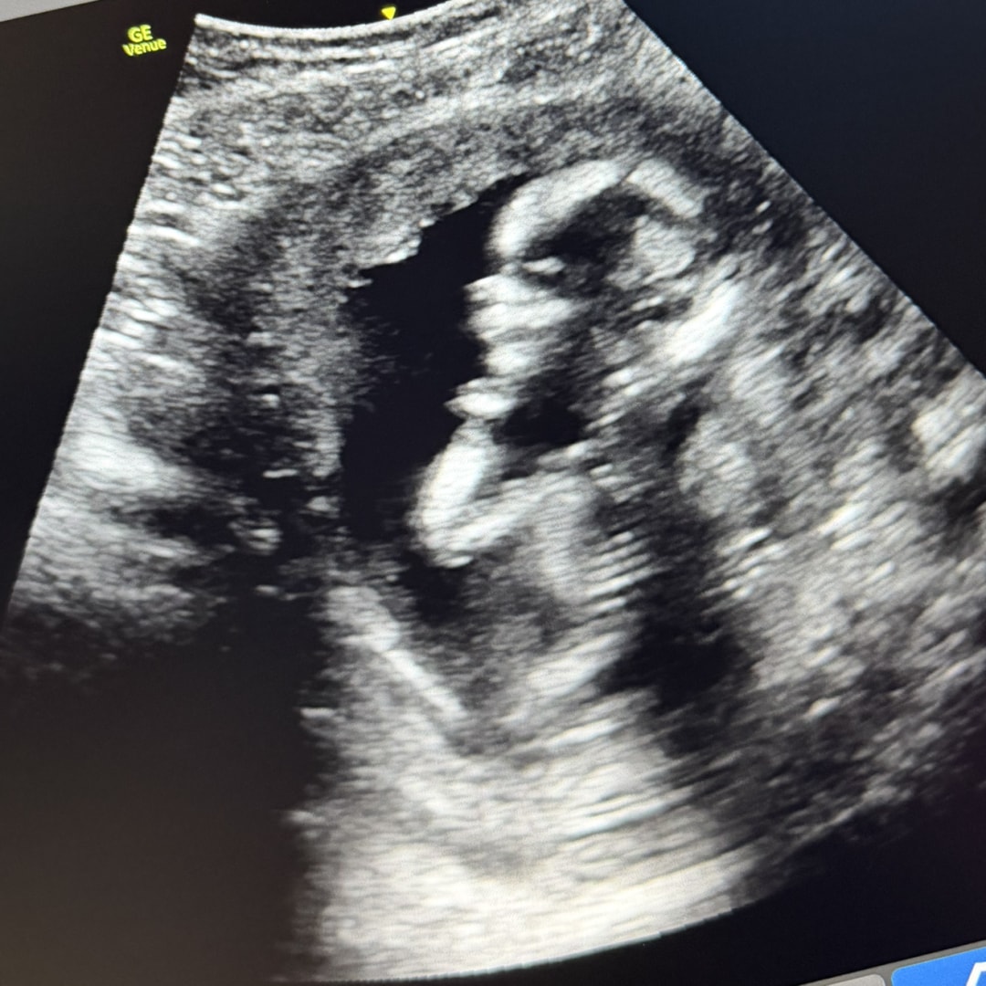 Photo shared by Allie for their Babylist baby registry.