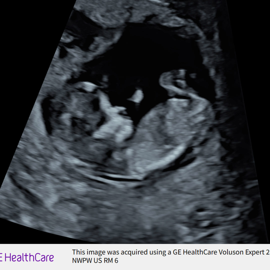 Photo shared by Julianna for their Babylist baby registry.