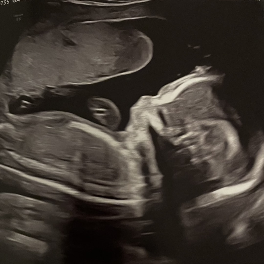 Photo shared by Dayanara for their Babylist baby registry.