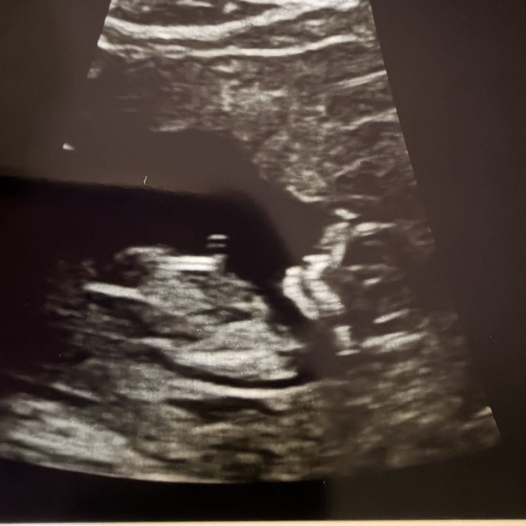 Photo shared by Tiffani for their Babylist baby registry.
