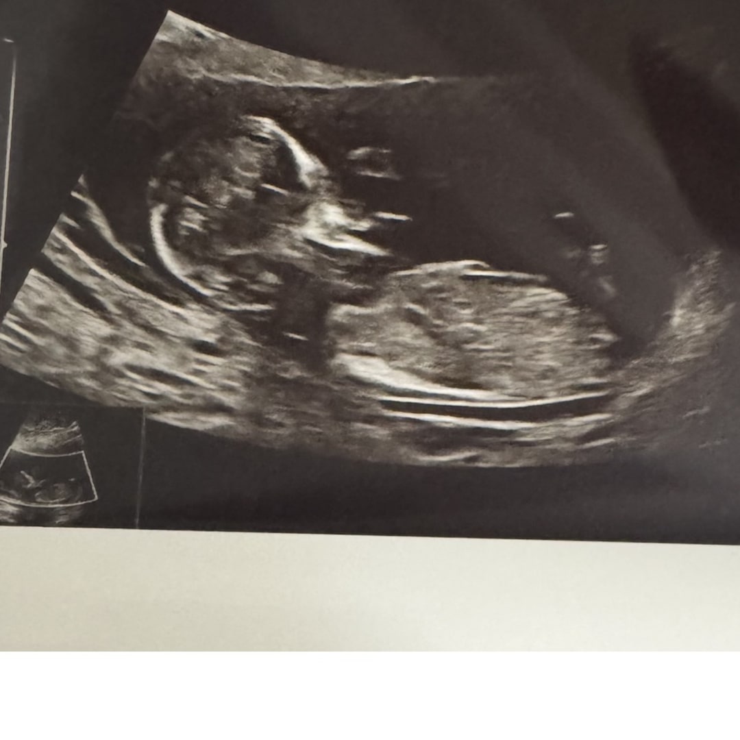 Photo shared by Juehl for their Babylist baby registry.