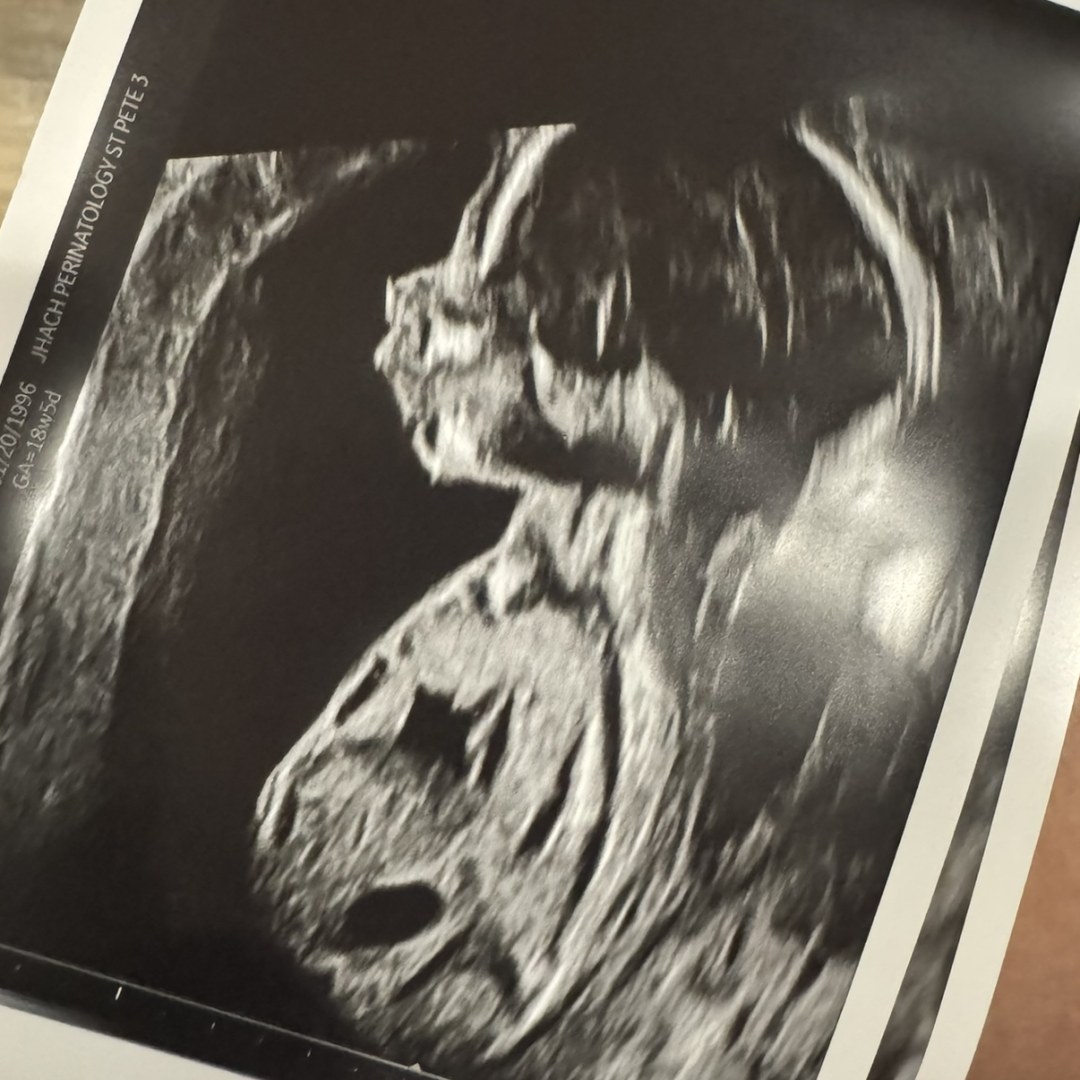 Photo shared by Katelyn for their Babylist baby registry.
