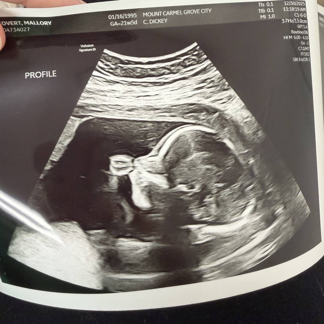 Photo shared by Mallory for their Babylist baby registry.