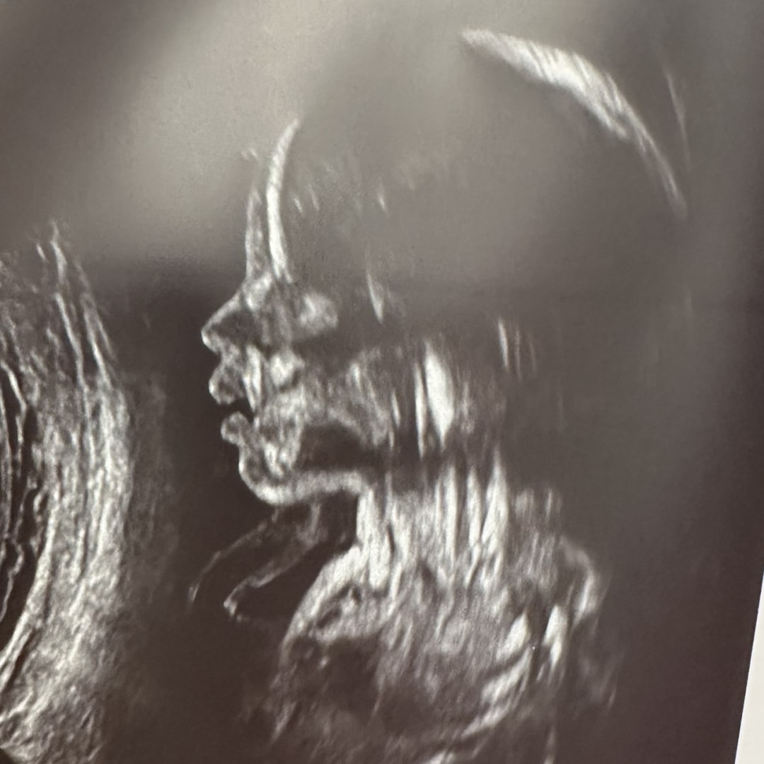 Photo shared by Samantha for their Babylist baby registry.