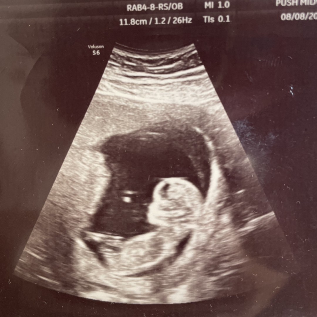 Photo shared by Ceci for their Babylist baby registry.