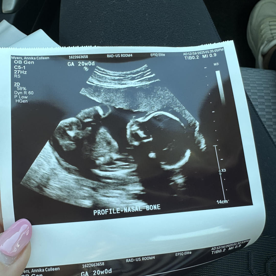 Photo shared by Annika for their Babylist baby registry.