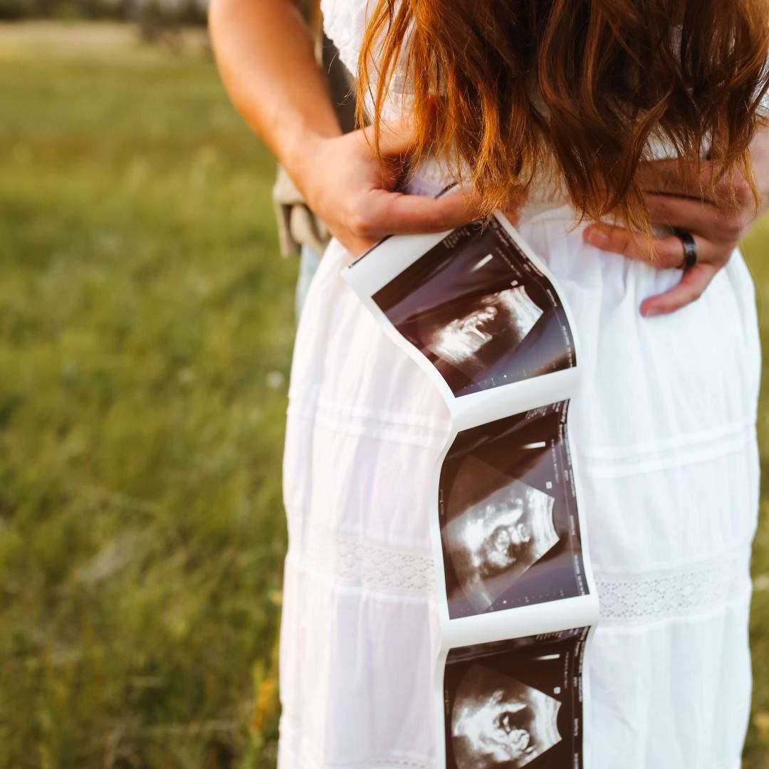 Photo shared by Charlie for their Babylist baby registry.