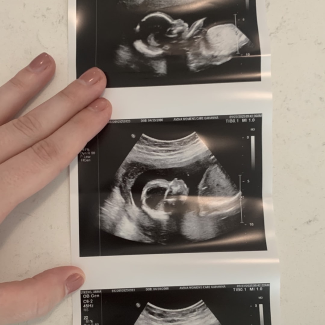 Photo shared by Anna for their Babylist baby registry.