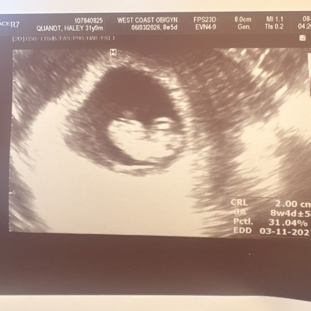 Photo shared by Haley for their Babylist baby registry.
