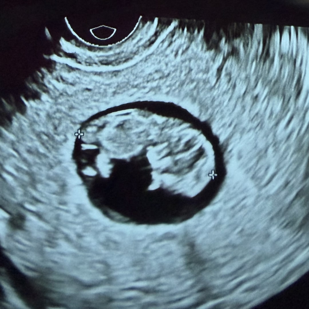 Photo shared by Romero for their Babylist baby registry.