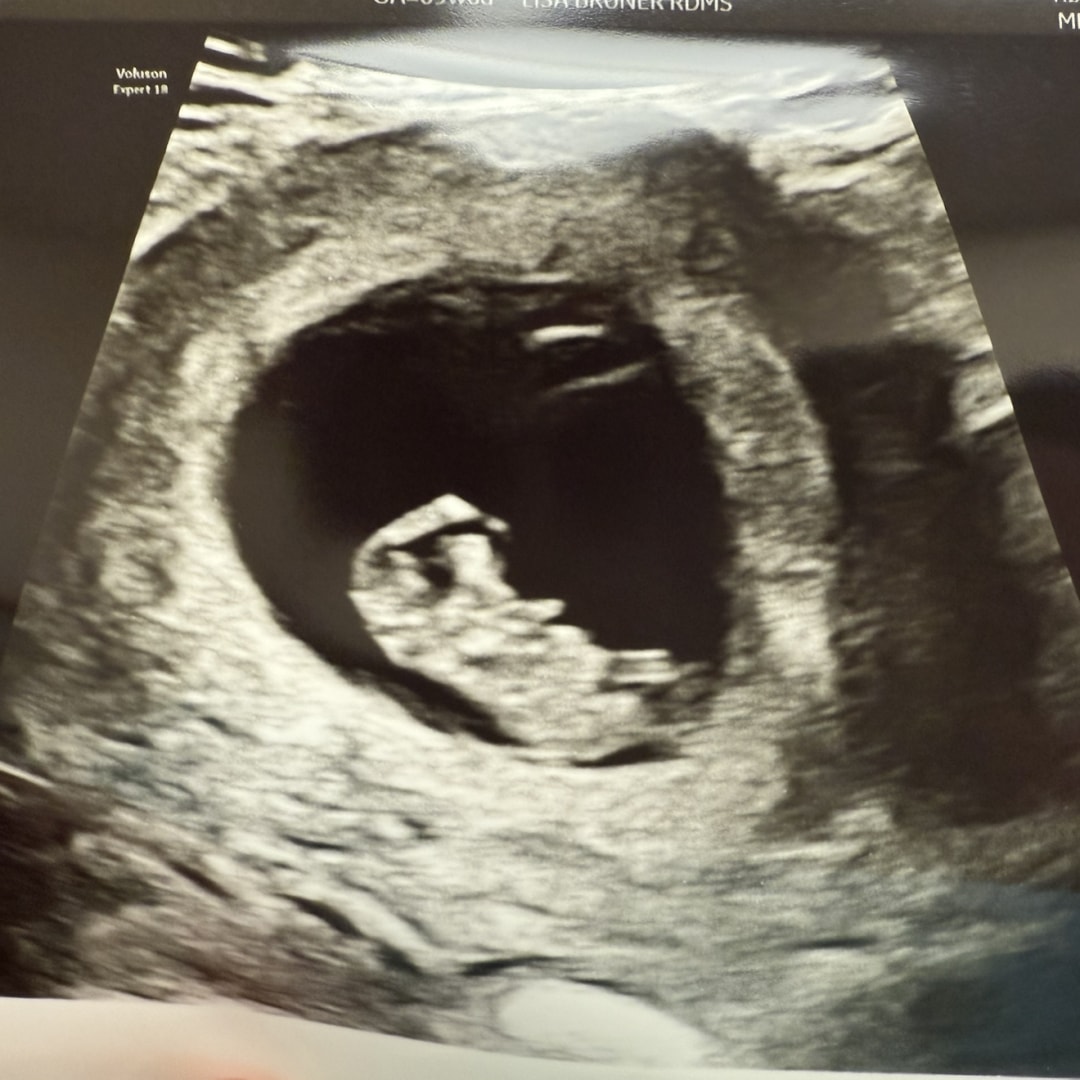 Photo shared by Lara for their Babylist baby registry.