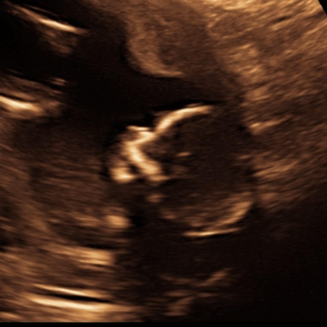 Photo shared by Christina for their Babylist baby registry.