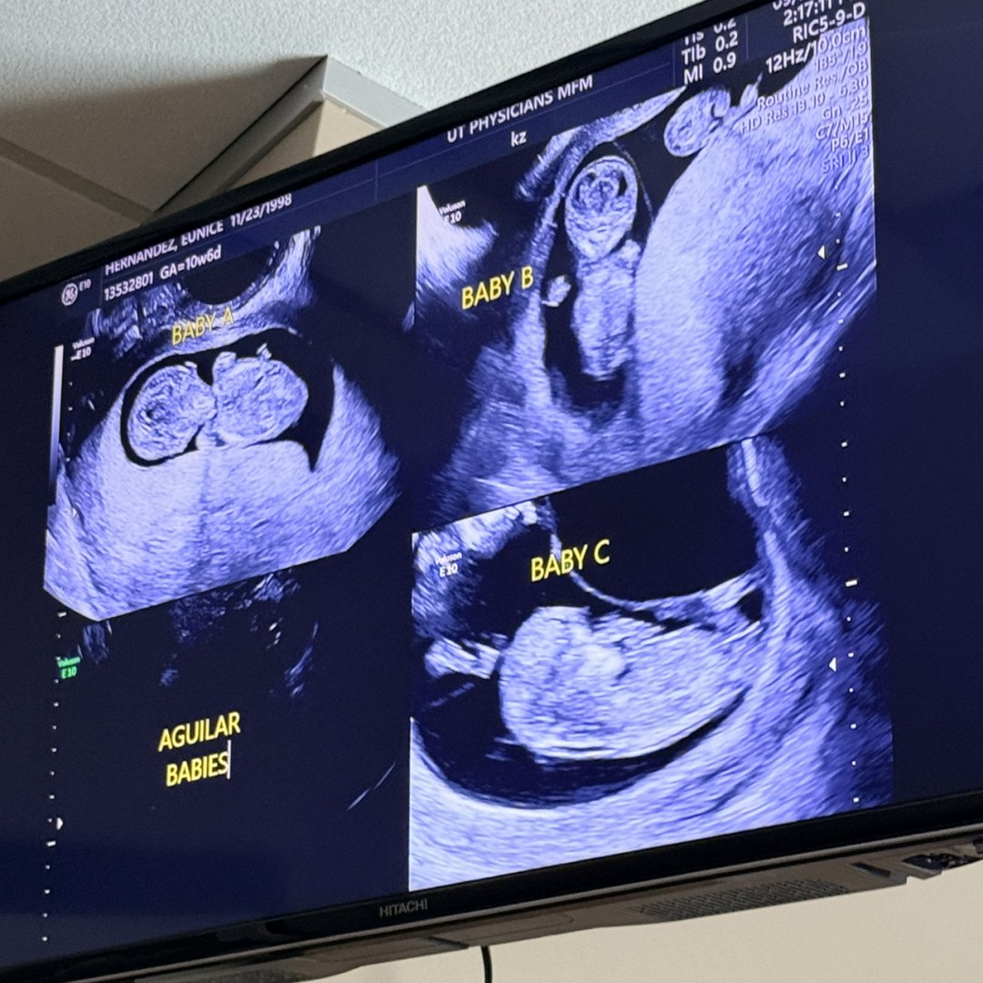 Photo shared by Eunice for their Babylist baby registry.