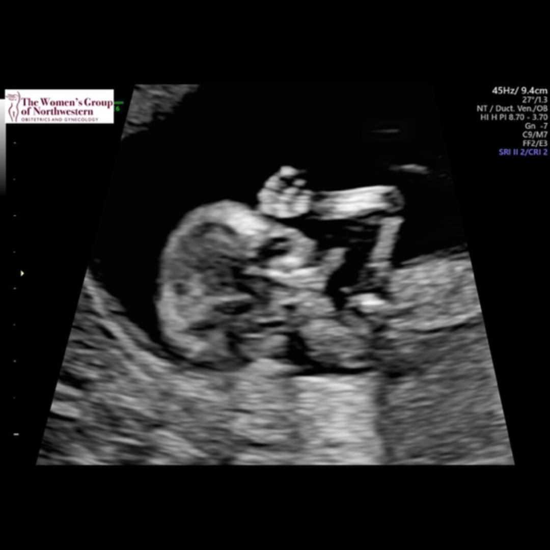 Photo shared by Kylee for their Babylist baby registry.