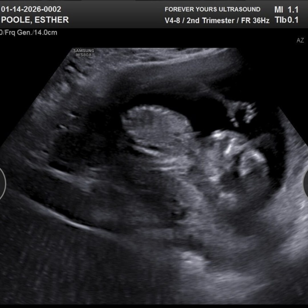 Photo shared by Esther for their Babylist baby registry.