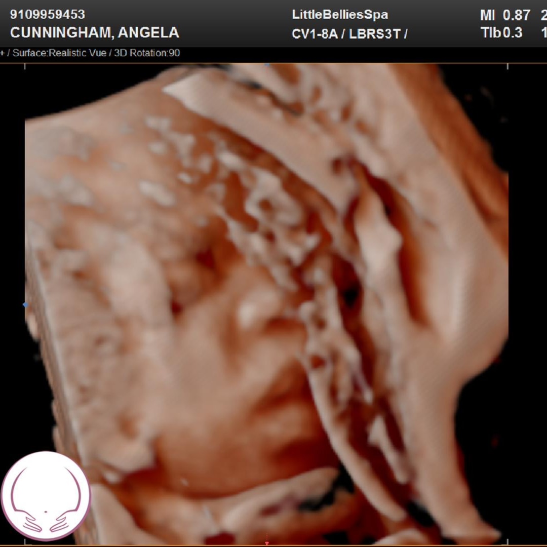 Photo shared by Angela for their Babylist baby registry.