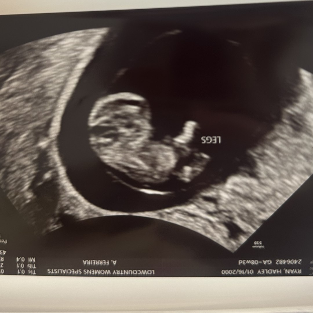 Photo shared by Hadley for their Babylist baby registry.