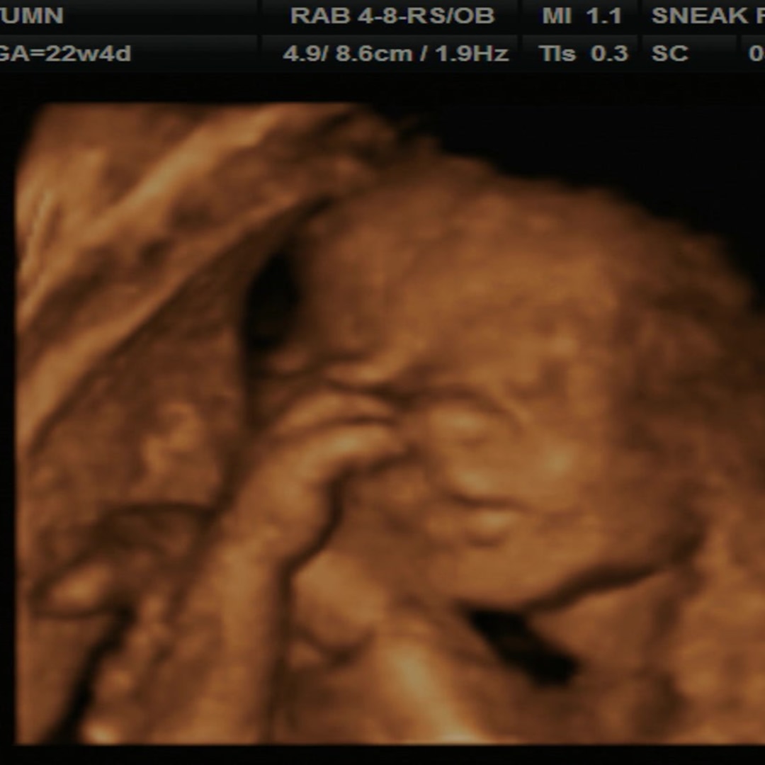 Photo shared by Autumn for their Babylist baby registry.