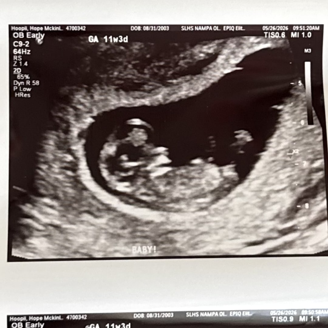 Photo shared by Hope for their Babylist baby registry.