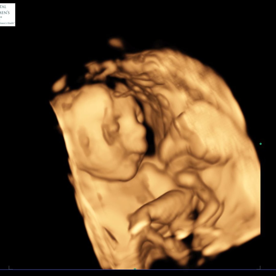 Photo shared by Sarah for their Babylist baby registry.