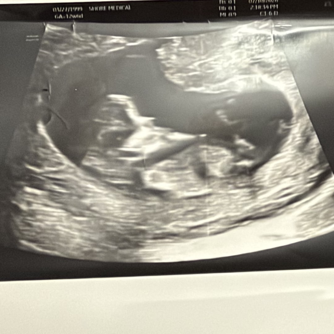 Photo shared by Emily for their Babylist baby registry.
