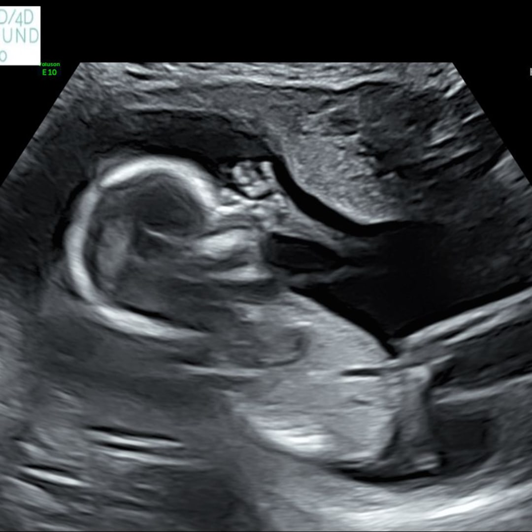 Photo shared by Kayla for their Babylist baby registry.