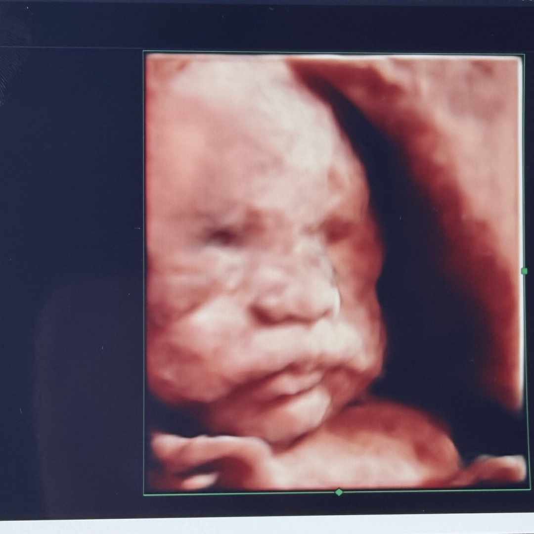 Photo shared by Kelsey for their Babylist baby registry.