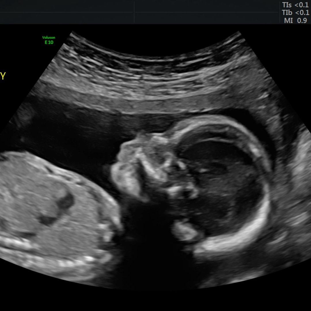 Photo shared by Grazia for their Babylist baby registry.