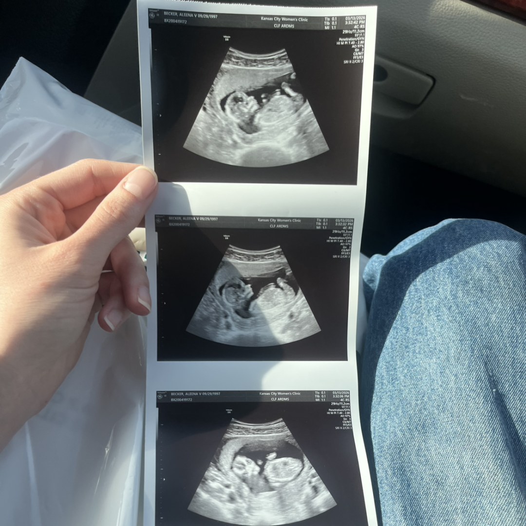 Photo shared by Aleena for their Babylist baby registry.