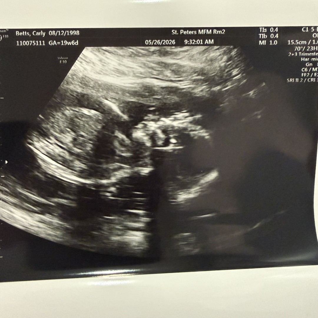 Photo shared by Carly for their Babylist baby registry.