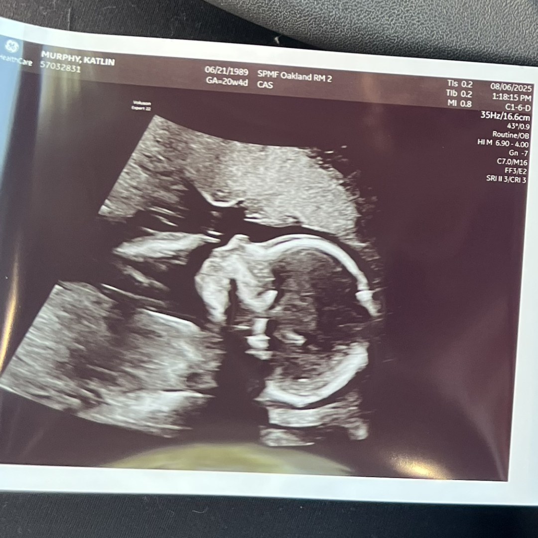 Photo shared by Katlin for their Babylist baby registry.