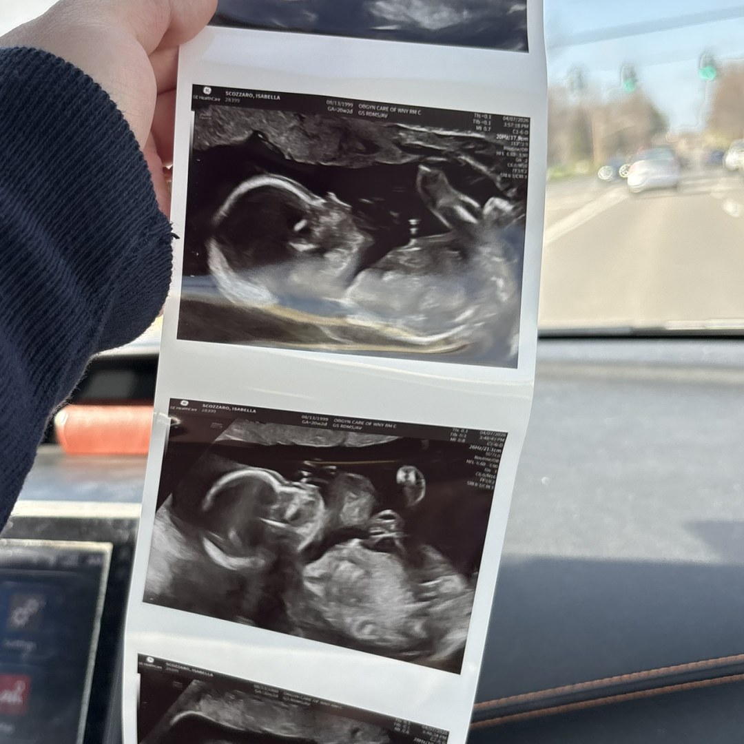 Photo shared by Bella for their Babylist baby registry.