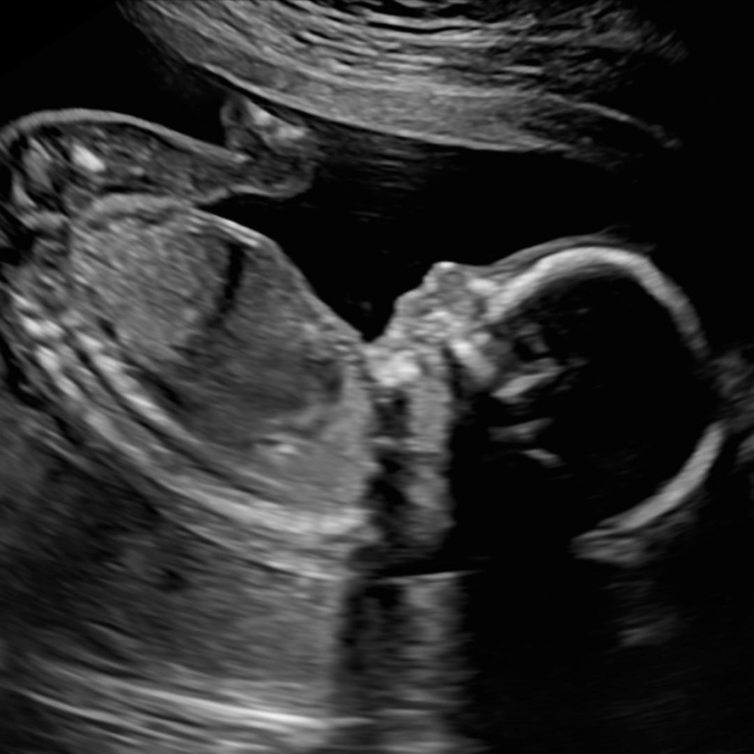 Photo shared by Bianca for their Babylist baby registry.