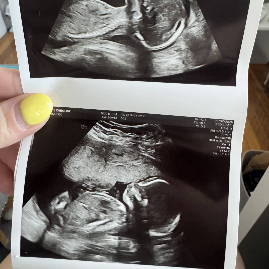 Photo shared by Caroline for their Babylist baby registry.