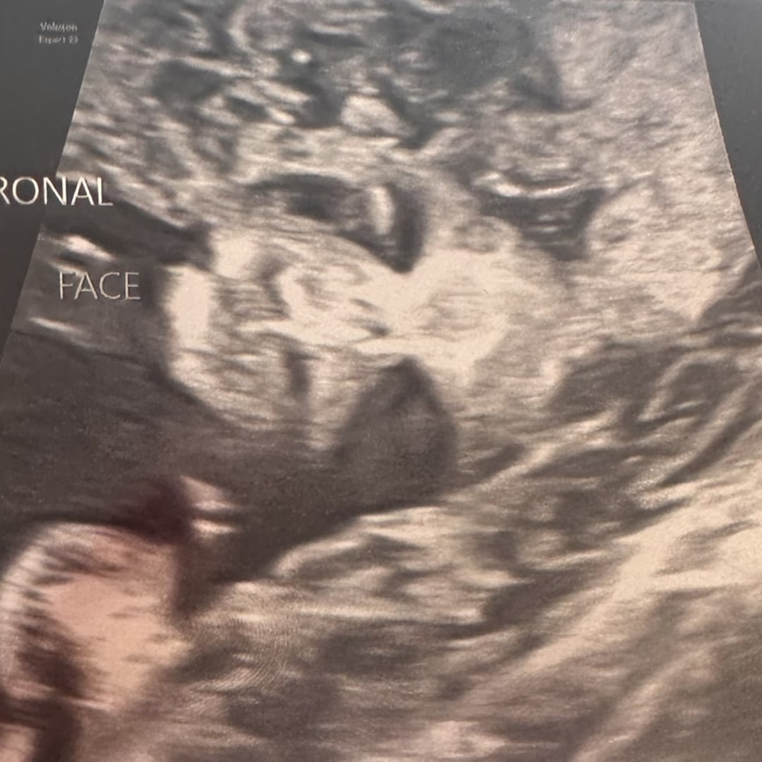 Photo shared by Jaqueline for their Babylist baby registry.