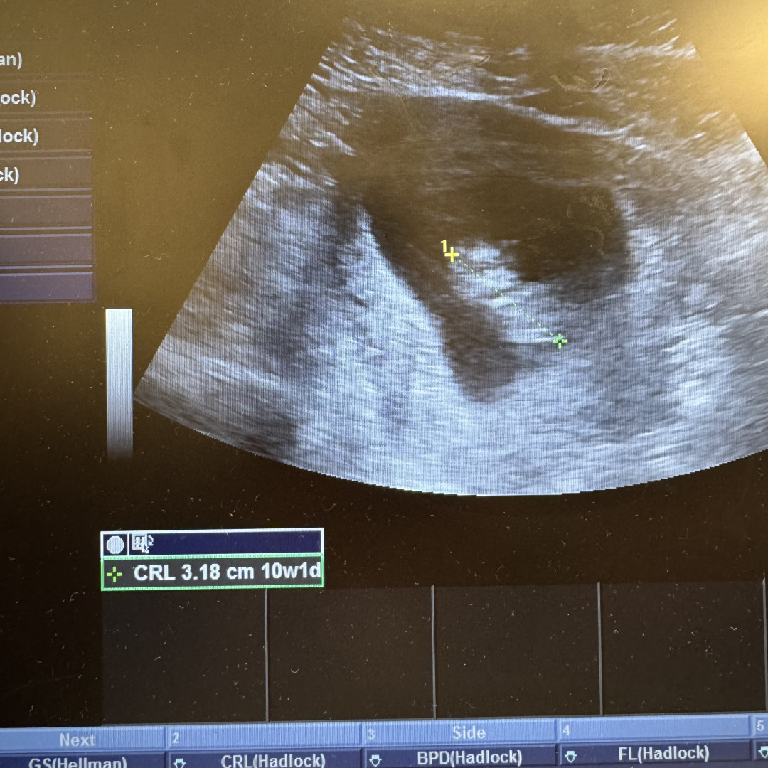 Photo shared by Carina for their Babylist baby registry.
