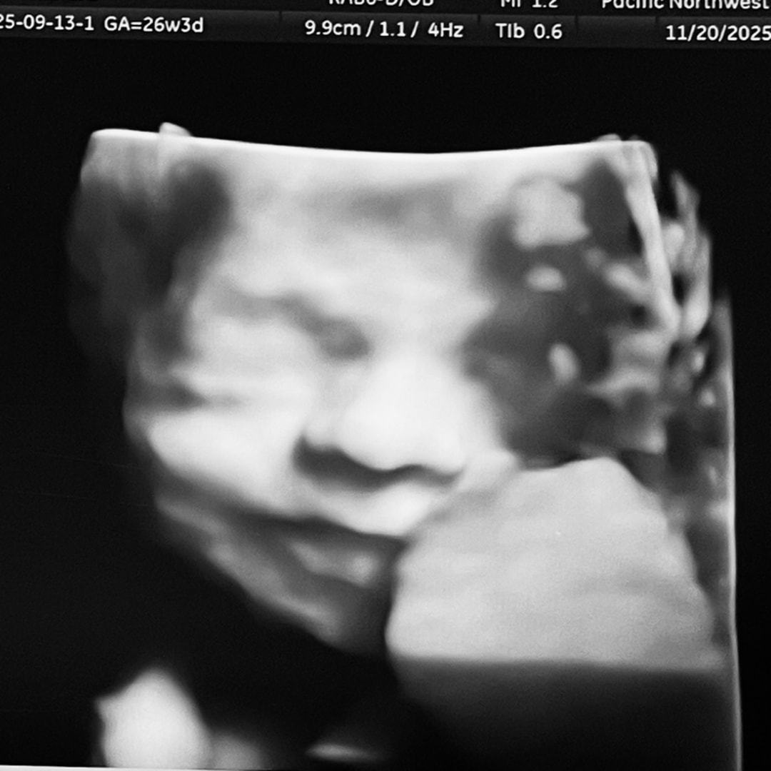 Photo shared by Ally for their Babylist baby registry.