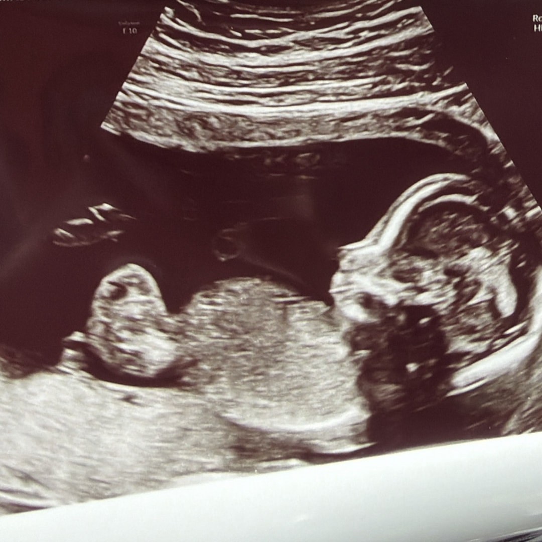 Photo shared by Ivory for their Babylist baby registry.