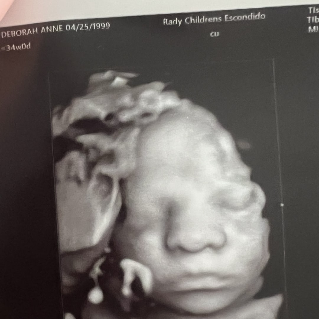 Photo shared by Sara for their Babylist baby registry.